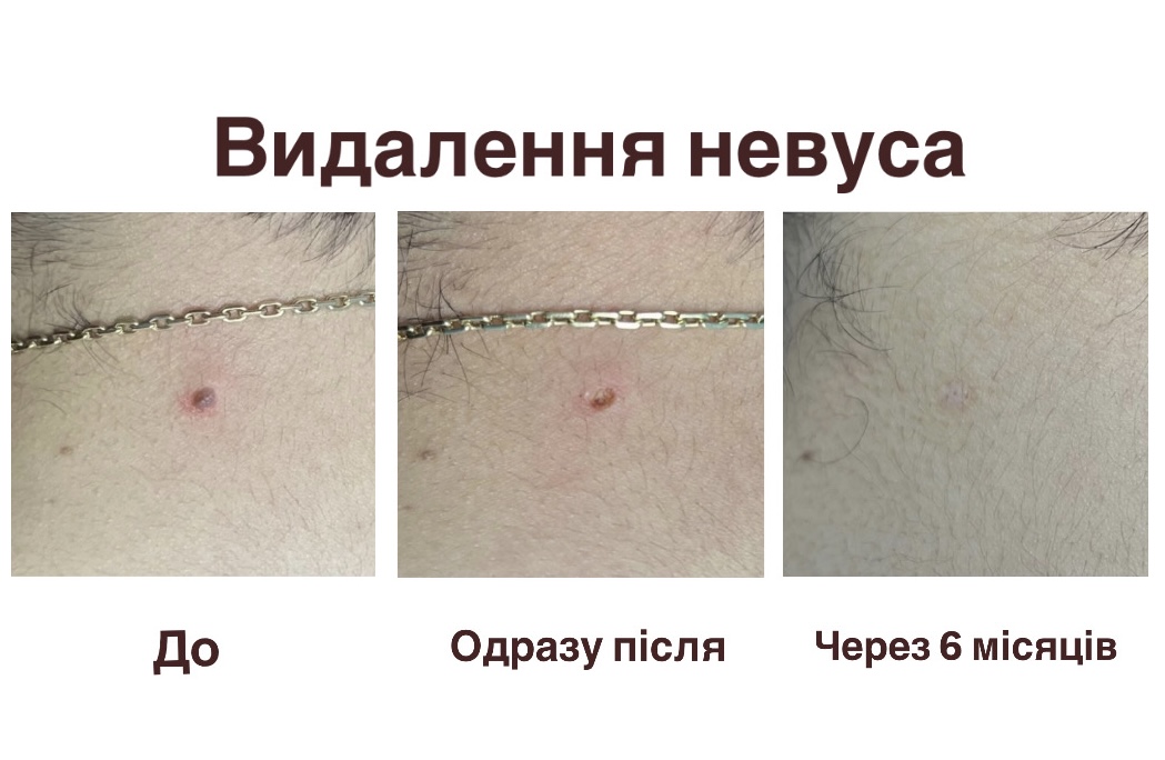Кейс №1