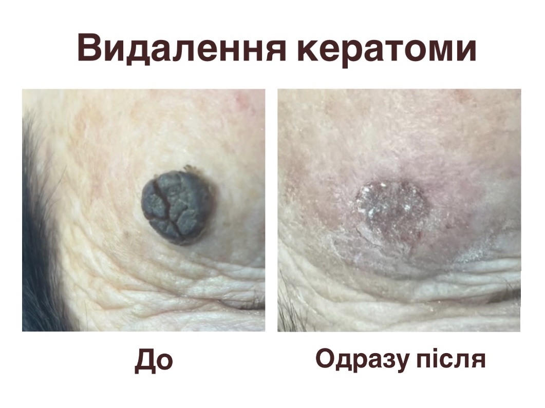 Кейс №2
