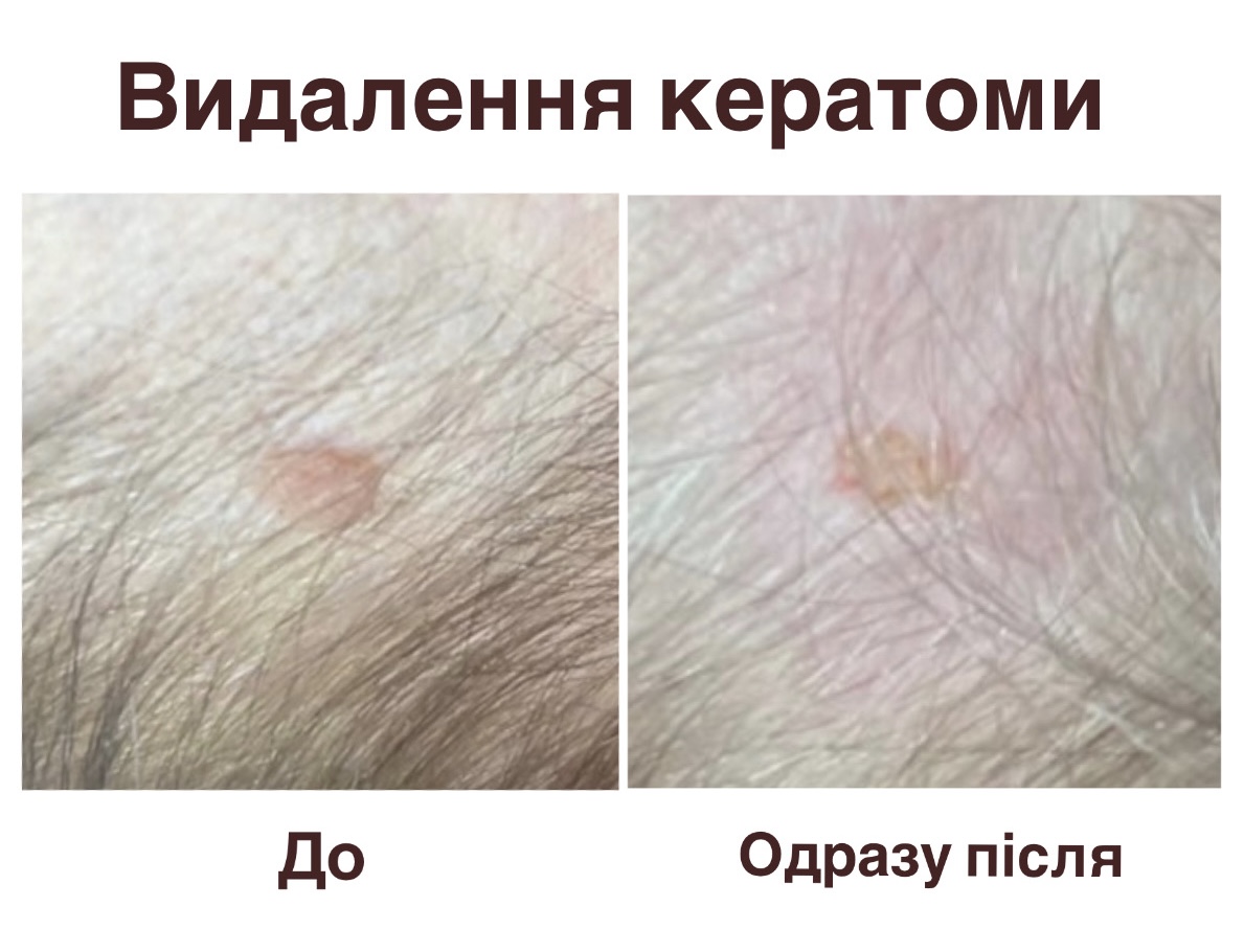 Кейс №3