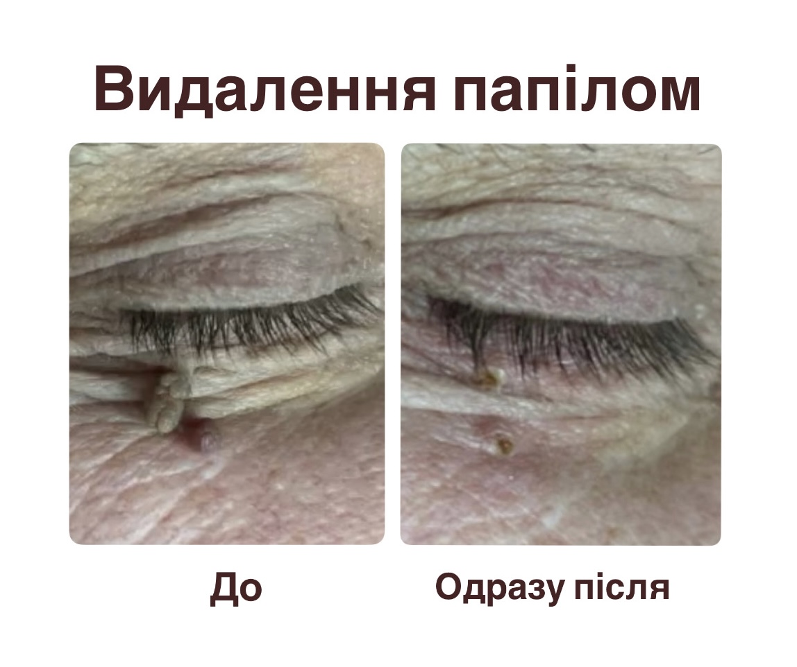 Кейс №4
