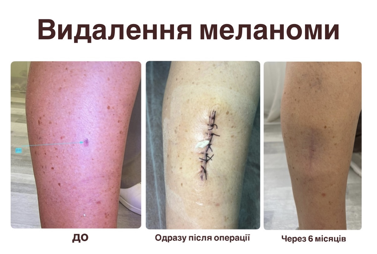 Кейс №5